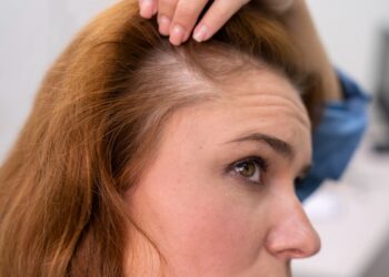 Home Remedies Against Hair Loss