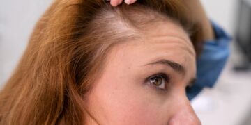 Home Remedies Against Hair Loss