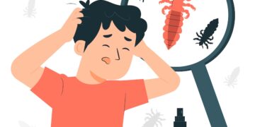 Head Lice