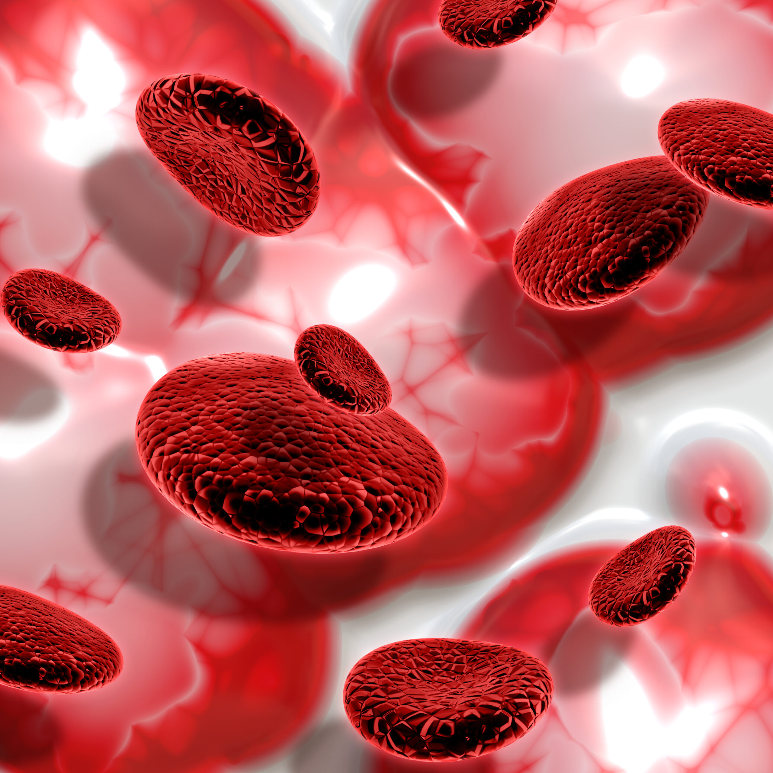 Polycythemia Vera   Pcv