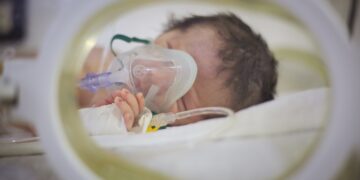 Respiratory Syncytial Virus (RSV)